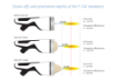 Obrazek INTELECT FOCAL SHOCKWAVE SET - CHATTANOOGA